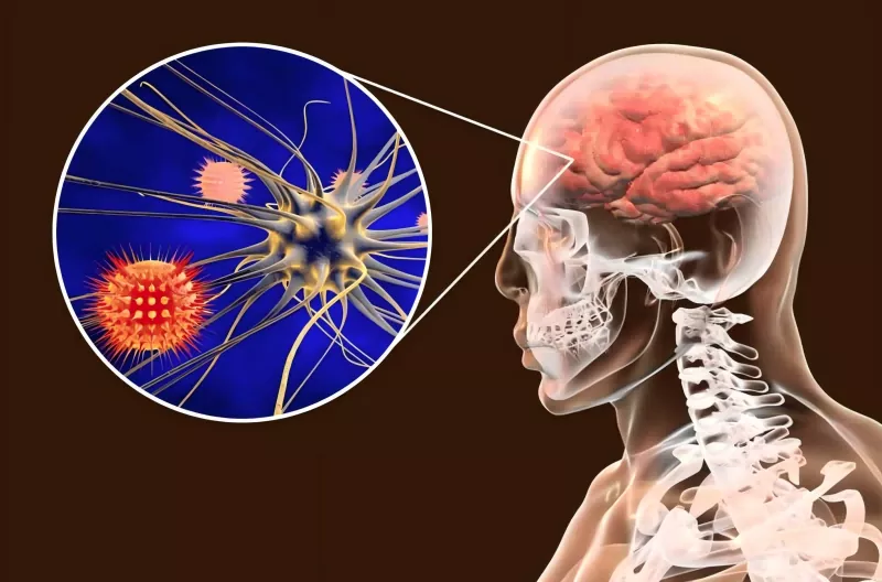 Meningokokvaccinevejledning Meningokokvaccinevejledning