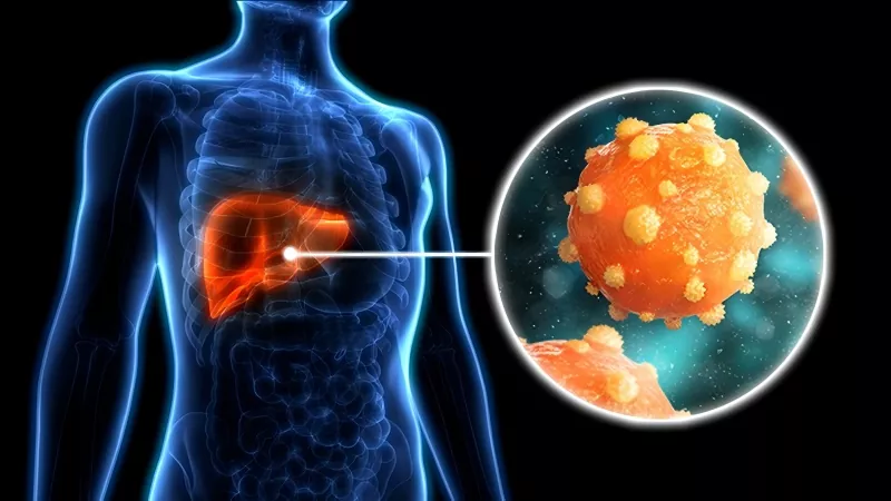 hepatitis B